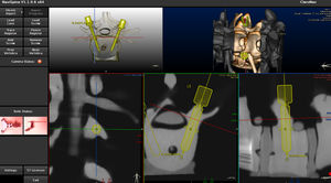 logiciel pour chirurgie robot-assistée