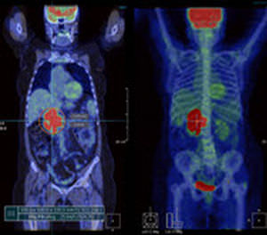 logiciel pour imagerie médicale