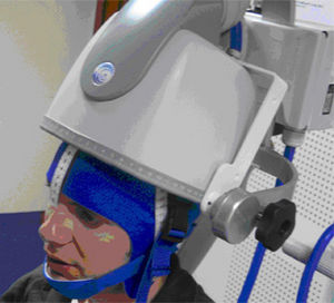 stimulateur magnétique transcrânien