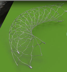 stent intracrânien