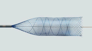stent intracrânien