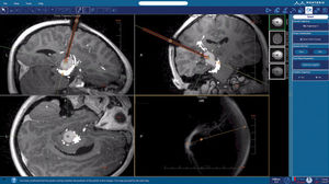 logiciel pour imagerie médicale