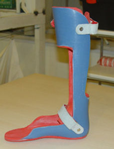 orthèse de cheville et de pied