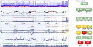 logiciel pour polysomnographie