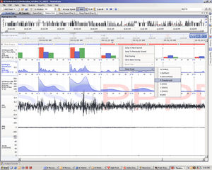 logiciel pour stimulation neurophysiologique