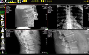 système de transmission pour imagerie médicale