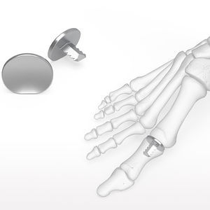 implant d'articulation interphalangienne du pied