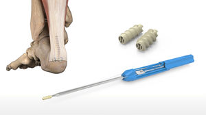 ancre de suture de tendon calcanéen