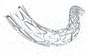 stent coronarien