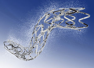 stent périphérique