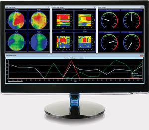 logiciel pour EEG