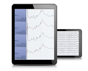 logiciel pour EEG