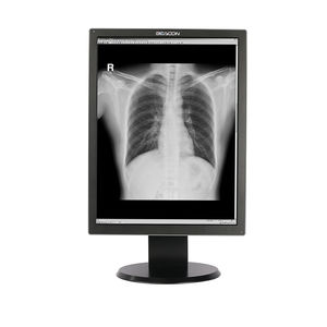 écran de diagnostic