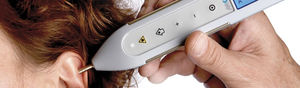 laser pour acupuncture