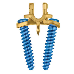 agrafe orthopédique d'arthrodèse vertébrale antérieure