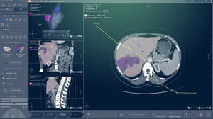 module logiciel de radiographie