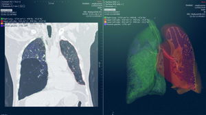 module logiciel pour radiologie