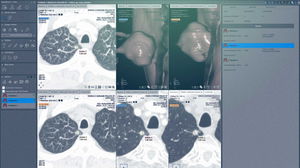 module logiciel de chirurgie