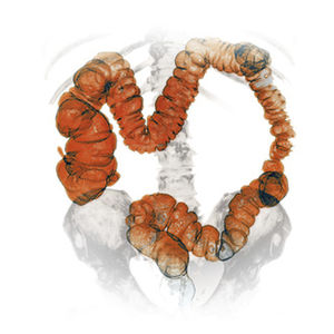 module logiciel d'analyse / de visualisation / d'oncologie / d'endoscopie