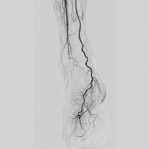 logiciel pour imagerie médicale