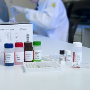 kit de test de l'hépatite C