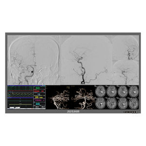 écran chirurgical