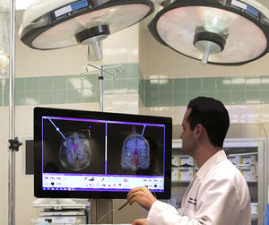 système de navigation chirurgicale pour neurochirurgie