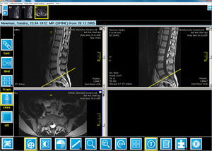 logiciel pour radiologie