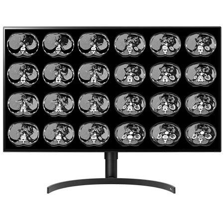Écran de diagnostic - CL8MPS32C - Double Black Imaging - 3840 × 2160 / 32" / LED