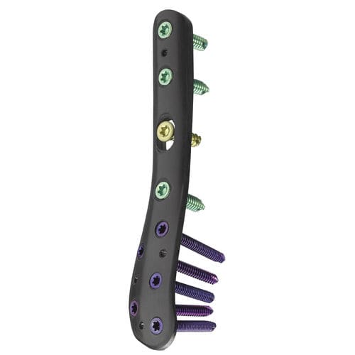 Plaque de compression de fibula - CarboFix Orthopedics - distale / verouillée / non verrouillée