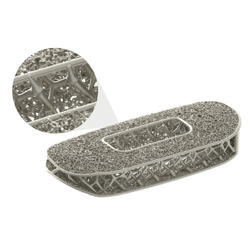 Cage intersomatique cervicale - Modulus® - NuVasive - voie antérieure ...