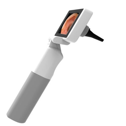 Otoscope vidéo vOtsco InfraEyes avec moniteur vidéo intégré