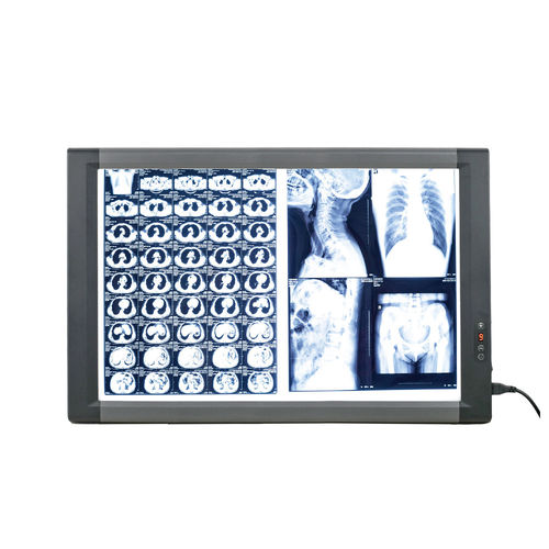 négatoscope numérique - Nanchang Micare Medical Equipment