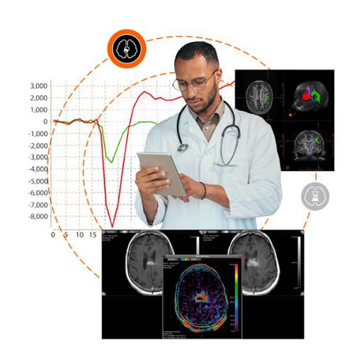 logiciel IRM - Olea Medical