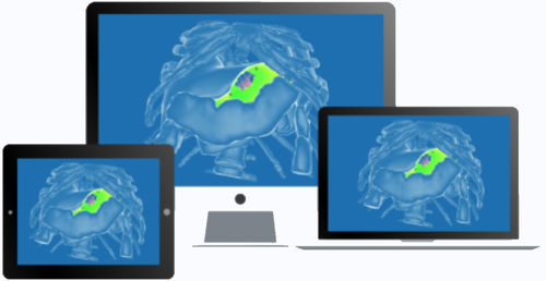Logiciel chirurgical - diSplay - InSimo - de visualisation / de planification / de test