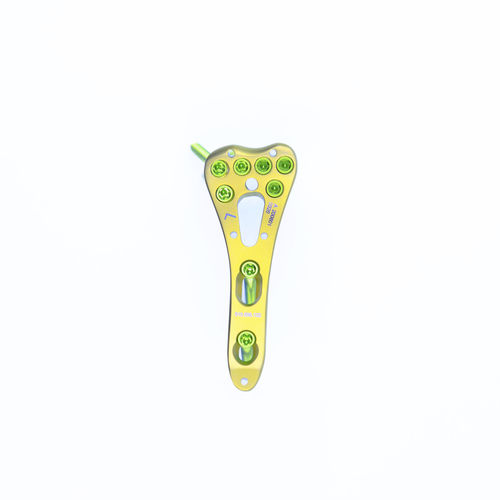 Plaque de compression de radius - SDP-69 - Chongqing FWS Medical Devices - distale / verouillée / en titane