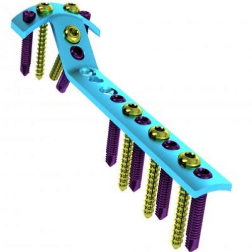 Plaque de compression de tibia - 5709-002-0 series - Ortobio - proximale / verouillée / en titane