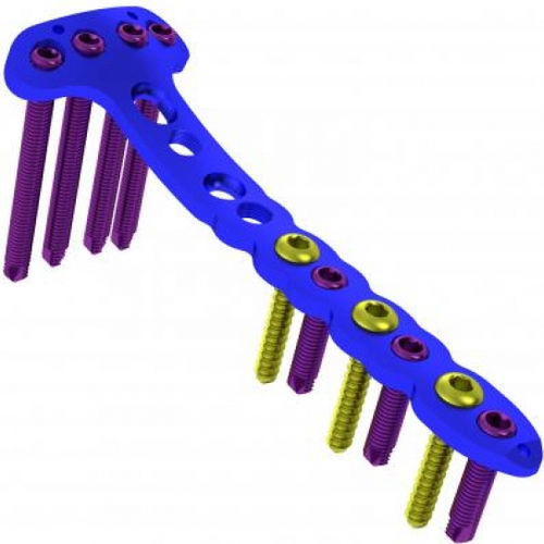 Plaque de compression de tibia - 5713-103 series - Ortobio - médiale / verouillée / en titane