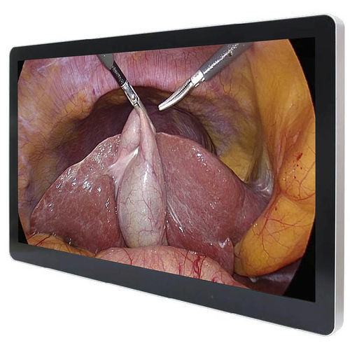 Moniteur médical - ECONT-0501.3 - Contact Co. - chirurgical / Full HD / 27"