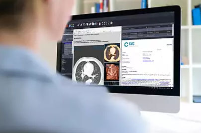 Module logiciel d'analyse - Philips Healthcare - de visualisation / de diagnostic / de gestion
