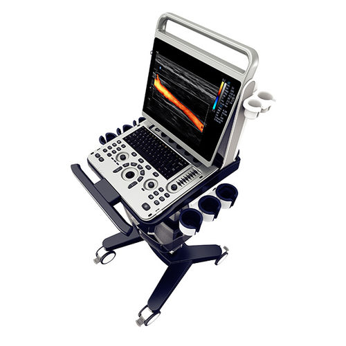 Échographe portable, avec chariot - EBit 30 - CHISON Medical Technologies - pour échographie polyvalente / pour échographie abdominale et pelvienne / pour échographie urologique