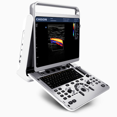 Échographe portable - EBit 20 - CHISON Medical Technologies - pour échographie polyvalente / pour échographie gynécologique et obstétrique / pour échographie abdominale et pelvienne