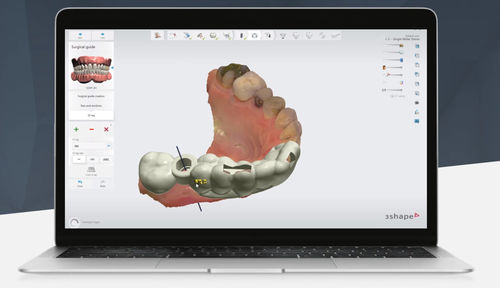 Logiciel de planification - Implant Studio™ - 3shape - de traitement / CAO / de conception de prothèse dentaire