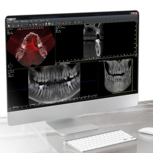 logiciel dentaire - Owandy Radiology