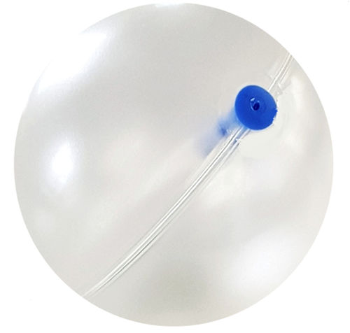 ballon intra-gastrique non chirurgical - Helioscopie