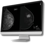 logiciel médical pour tomosynthèse mammaire