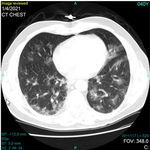 logiciel de diagnostic du Covid-19