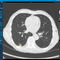logiciel d'analyseVAREX Imaging
