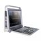 échographe portableP60Xuzhou Ruisheng Chaoying Electronic Technology