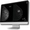 logiciel médical pour tomosynthèse mammaireBreast-SlimView&reg;Hera-MI